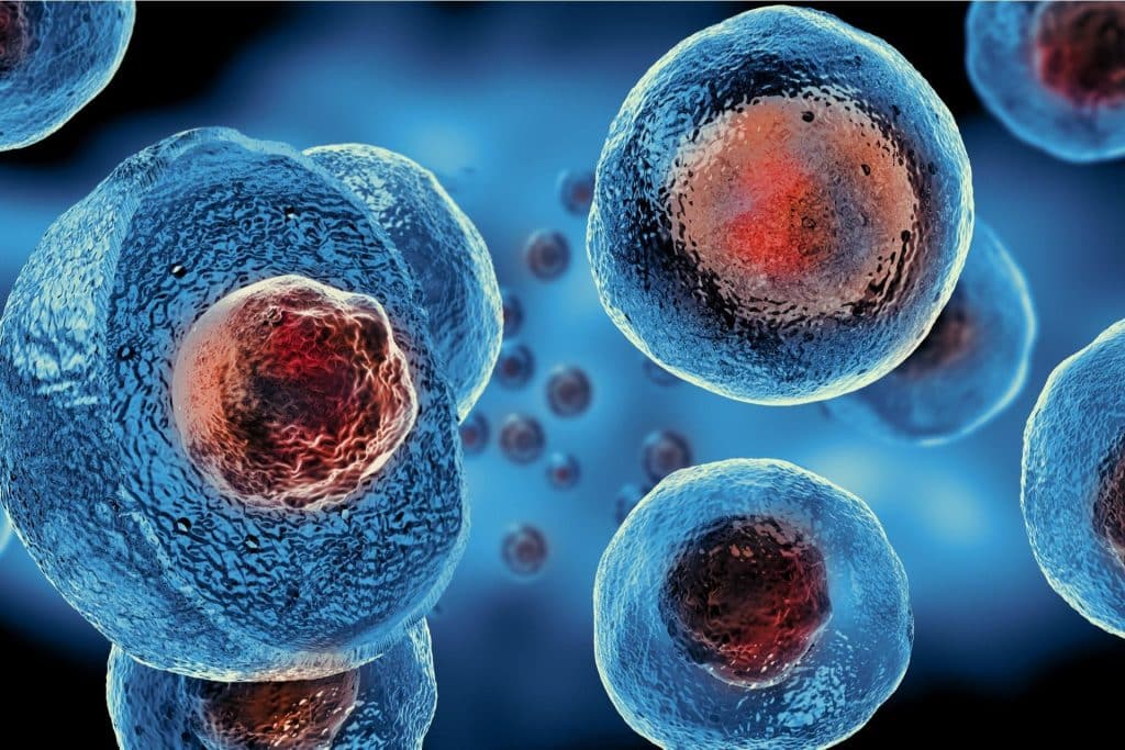 Stemcell Therapy Florida