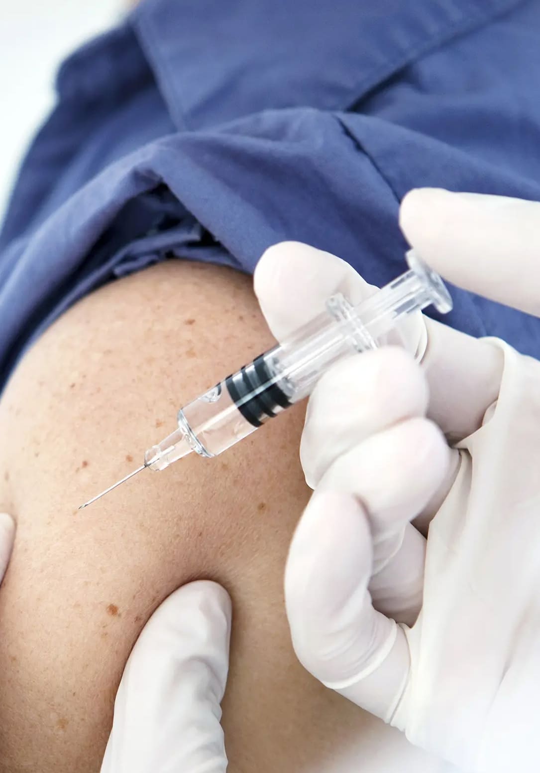 P-Shot for Men: winter park regenerative medicine