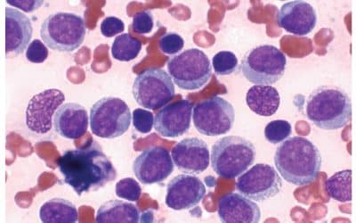 Bone Marrow Aspirate Concentrate Treatments