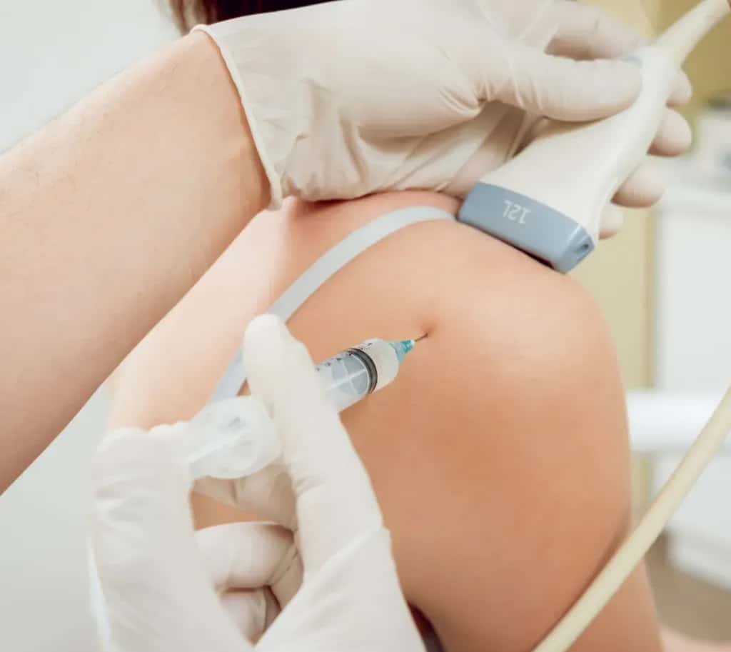 Stem Cell Injection