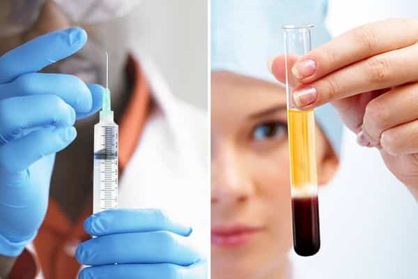 Stem Cell Injections