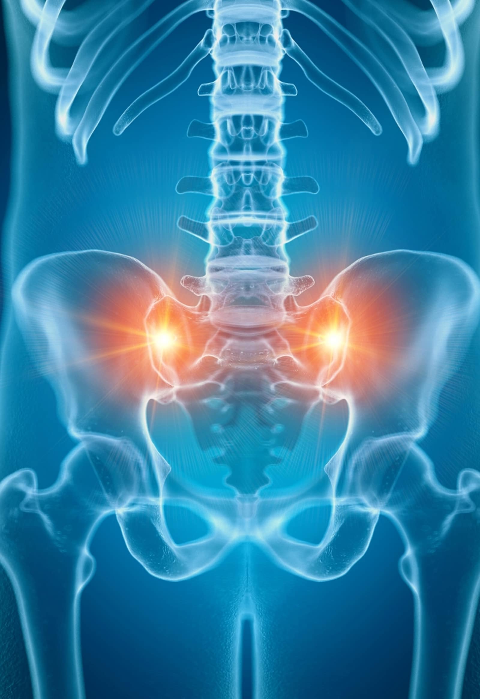  Sacroiliac Joint Dysfunction