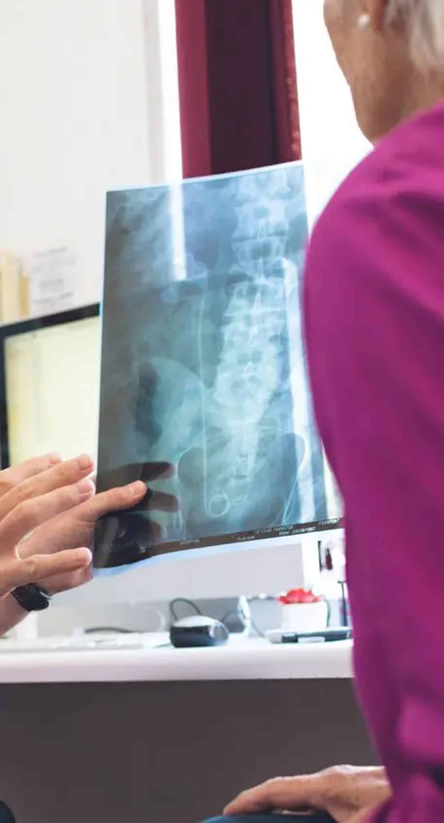 Sacroiliac Joint Pain Treatment
