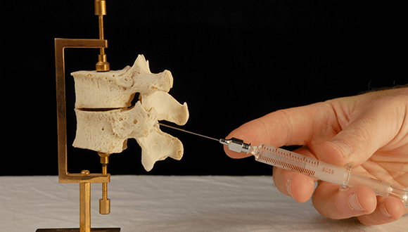 Prolotherapy Near Me