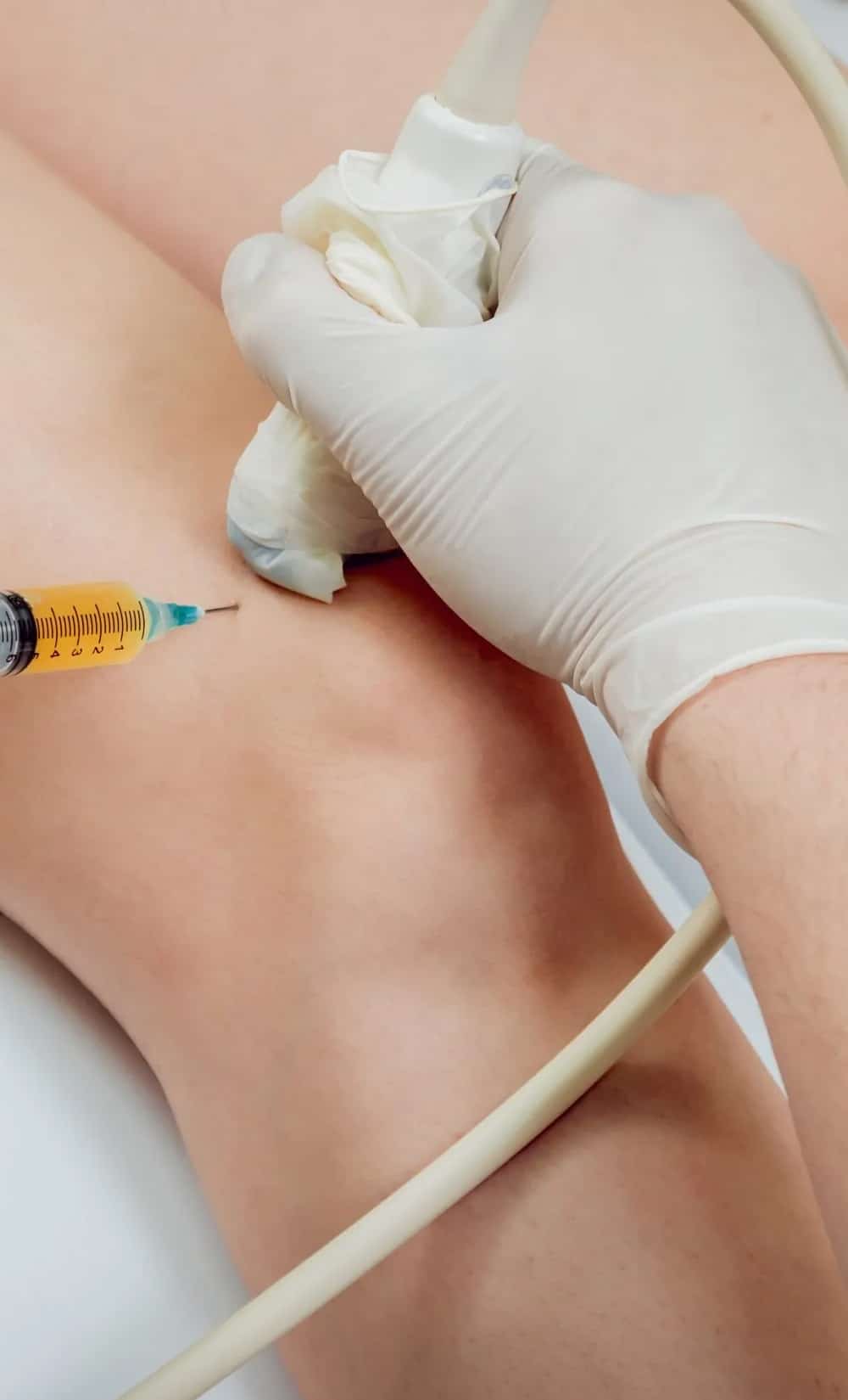 Prolotherapy Benefits