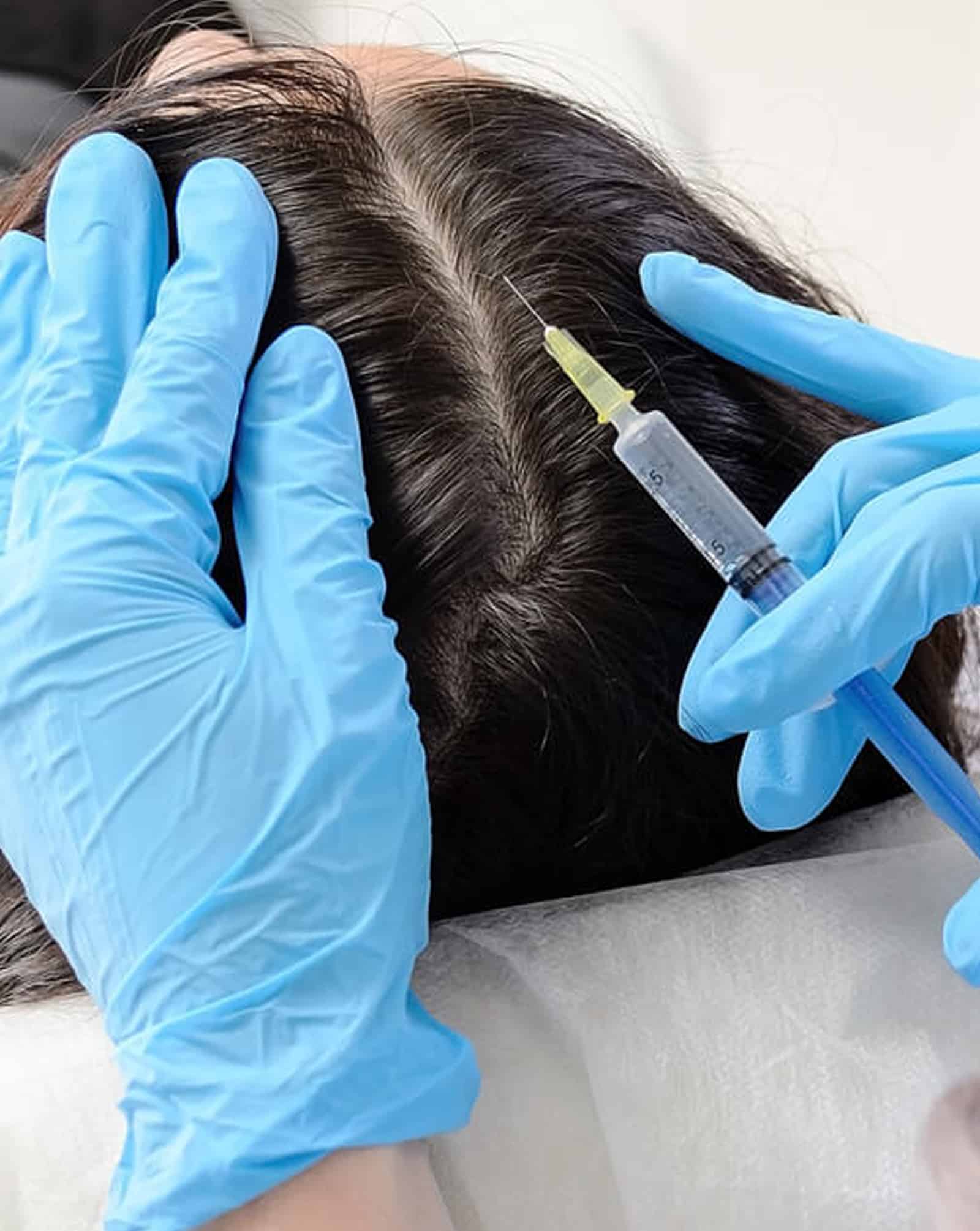 Advanced Hair Restoration Treatments