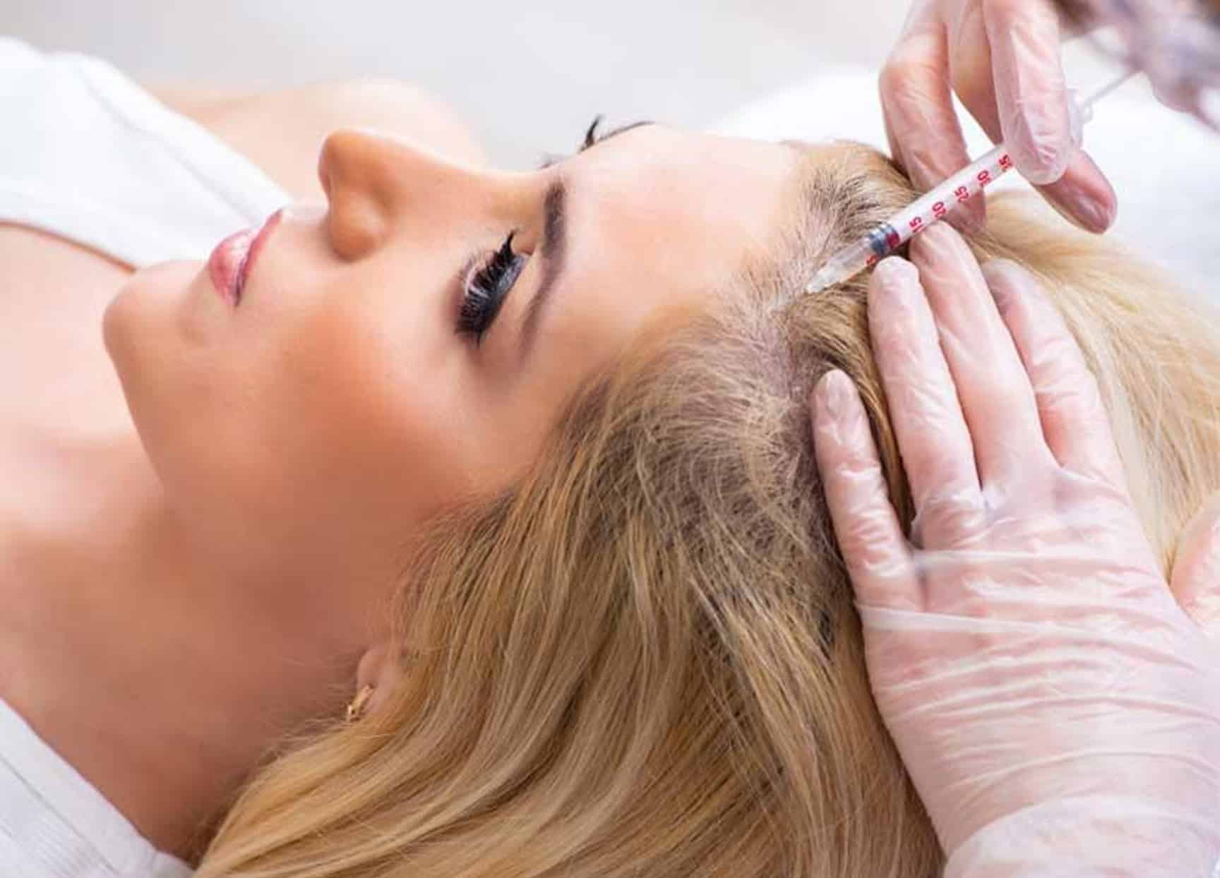 HAIR RESTORATION
