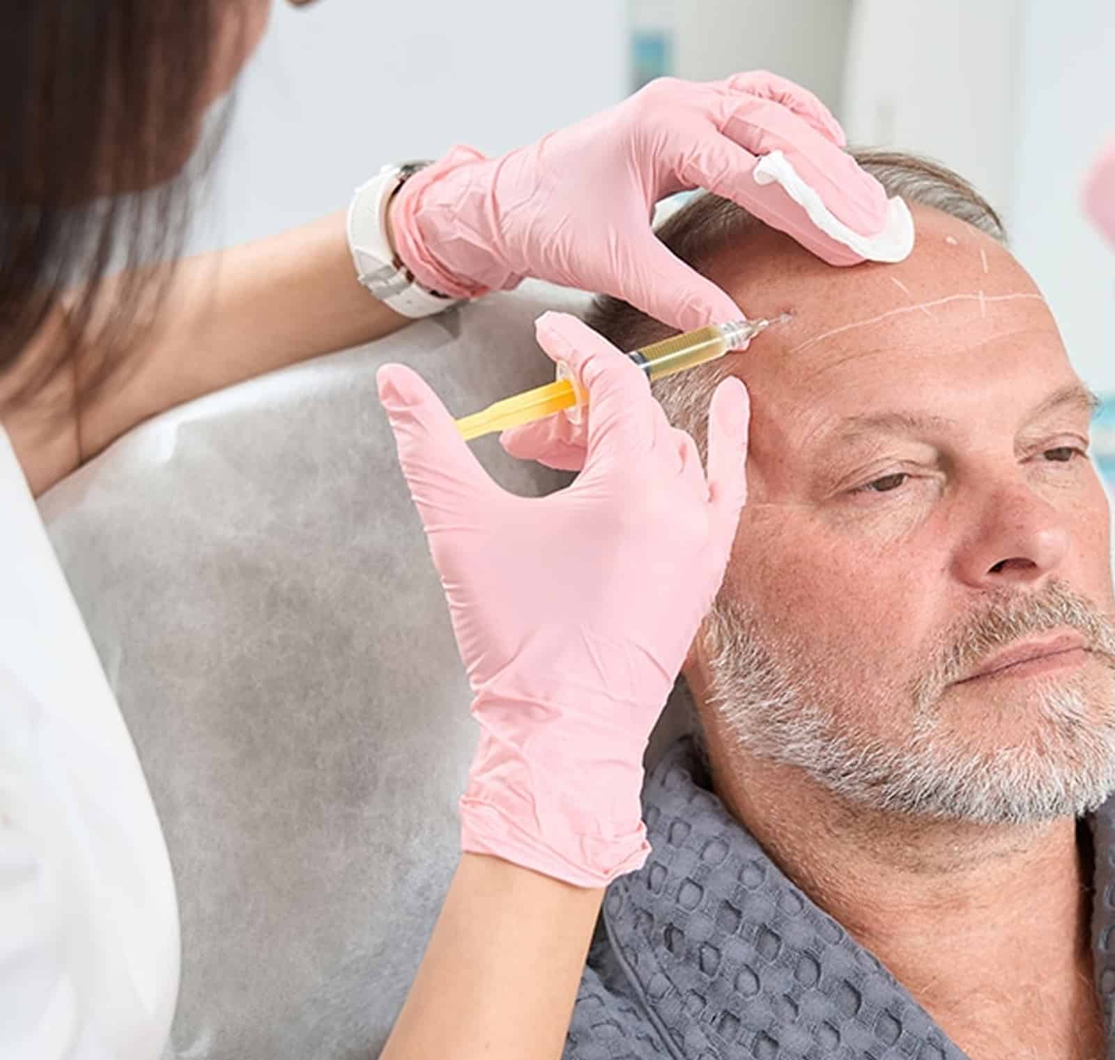 Hair Restoration Experience