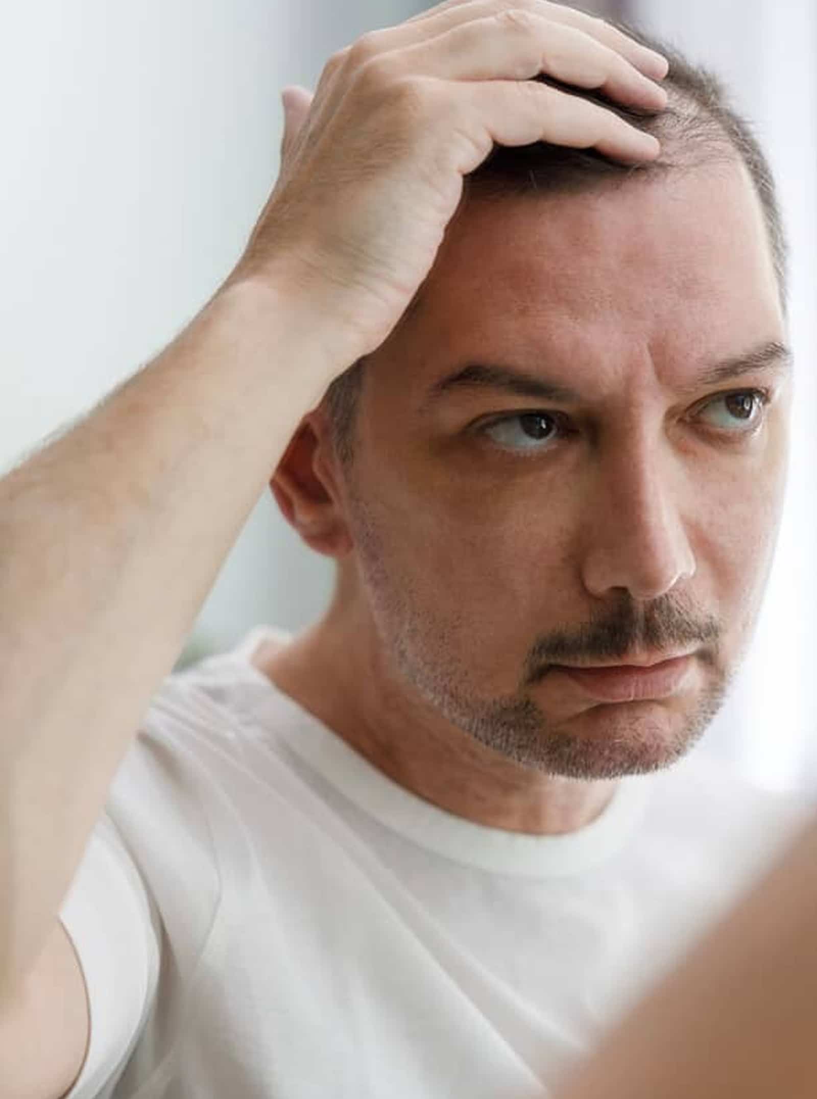  Hair Thinning and Shedding