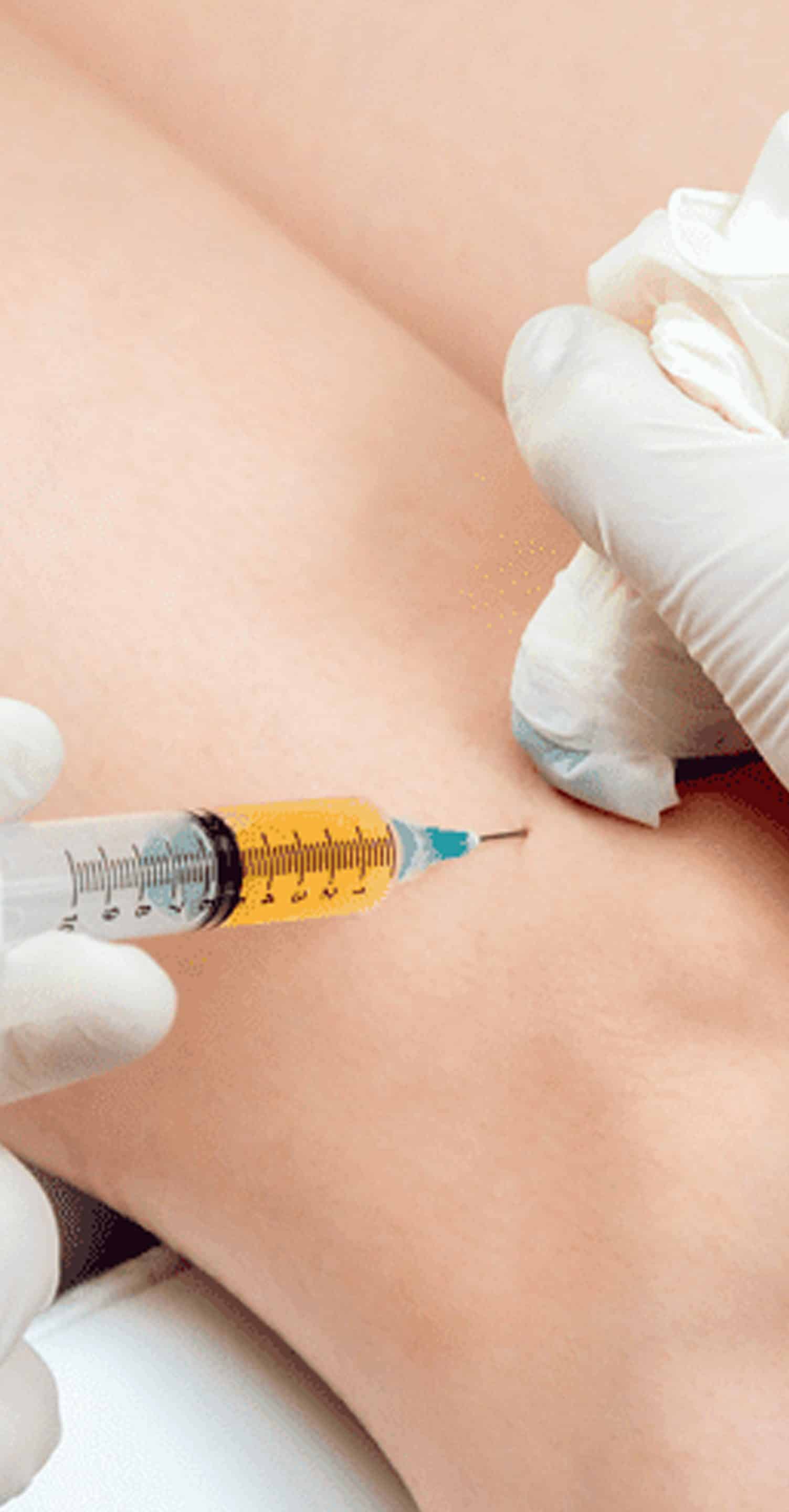 O-Shot Appointment