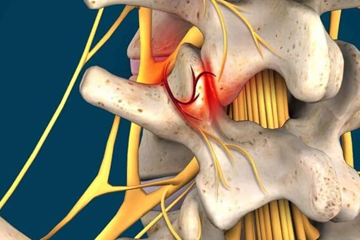 Serotonin-Norepinephrine Reuptake Inhibitors