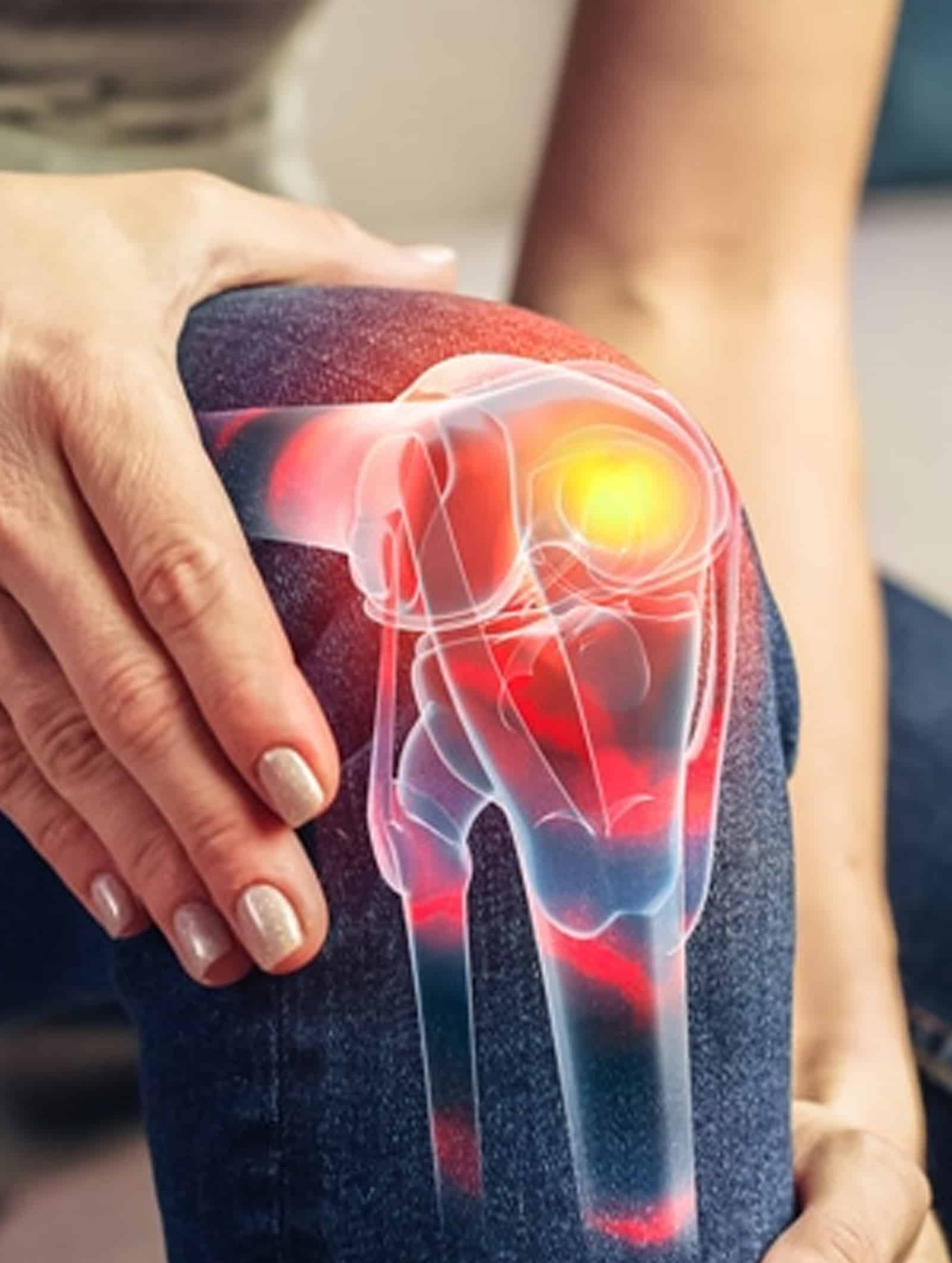 Knee Joint Pain Winter Park